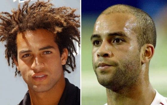 James Blake lembra o penteado que o fez perder um milhão