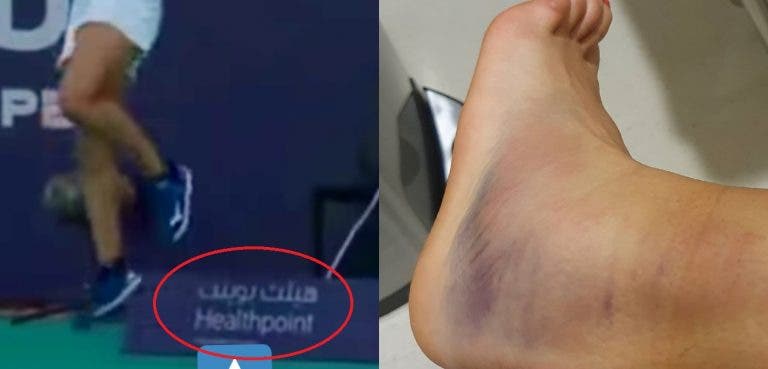 Arrepiante: Flipkens mostra como ficou o tornozelo e foi atendida no hospital da publicidade que a lesionou
