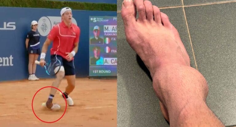 ARREPIANTE: Cazaux torce o pé em Barcelona e partilha imagem impactante da lesão